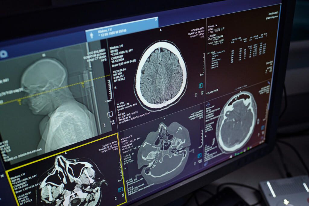 A computer screen displays multiple CT and MRI brain scan images, showing cross-sectional views from different angles, alongside detailed medical data—exemplifying the high standards of cardiac imaging services UK professionals offer.