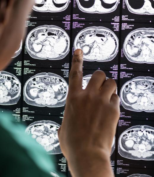 Doctor reading brain MRI x-ray result Doctor reading brain MRI x-ray results