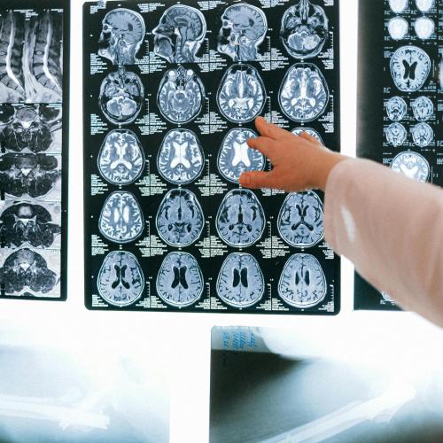 A person in a medical coat, possibly one of the cardiac and thoracic imaging specialists, points at brain scans on a light board, surrounded by spinal and skeletal X-ray images.